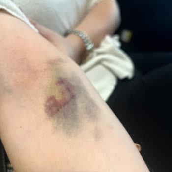 Medical Park Hastanesi Acil Hemşiresi Şikayet