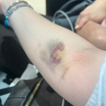 Medical Park Hastanesi Acil Hemşiresi Şikayet