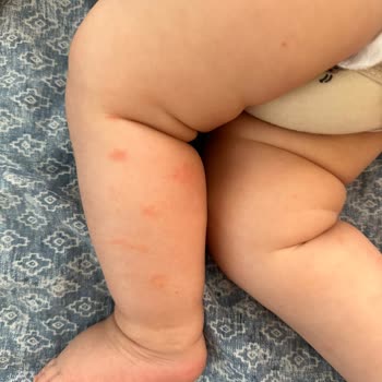 Mustela Kesinlikle Kullanılmaması Gereken Bir Ürün