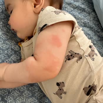 Mustela Kesinlikle Kullanılmaması Gereken Bir Ürün