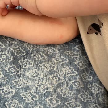 Mustela Kesinlikle Kullanılmaması Gereken Bir Ürün