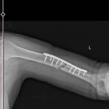 Tabii Ki Yine Doğa Sigorta Skandalı İle Baş Başayız