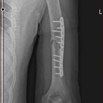 Tabii Ki Yine Doğa Sigorta Skandalı İle Baş Başayız