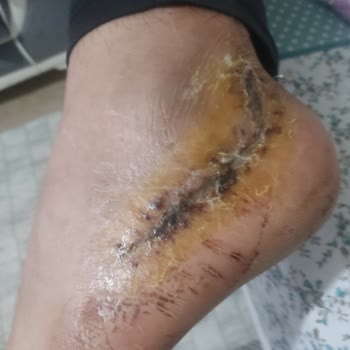 Tabii Ki Yine Doğa Sigorta Skandalı İle Baş Başayız