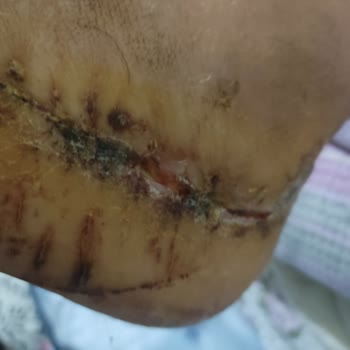 Tabii Ki Yine Doğa Sigorta Skandalı İle Baş Başayız