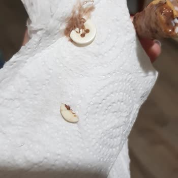 Algida Kornet Dondurmada Çıkan Düğme