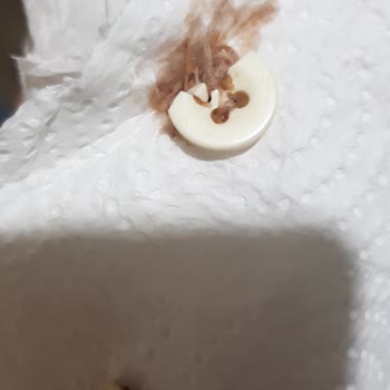 Algida Kornet Dondurmada Çıkan Düğme