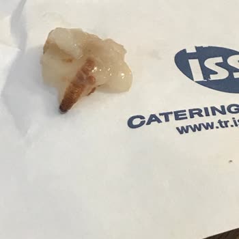 Medical Park Kocaeli Iss İnsan Sağlığıyla Oynuyor