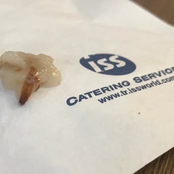 Medical Park Kocaeli Iss İnsan Sağlığıyla Oynuyor