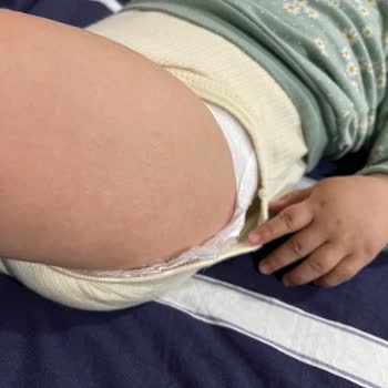 Sleepy Extra Baby Wet Wipes Islak Mendil Alerji!