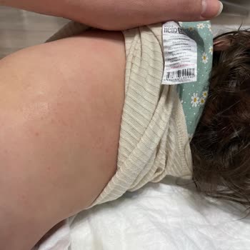 Sleepy Extra Baby Wet Wipes Islak Mendil Alerji!