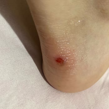 Skechers D'lites Ayakkabı Ayağıma Vuruyor