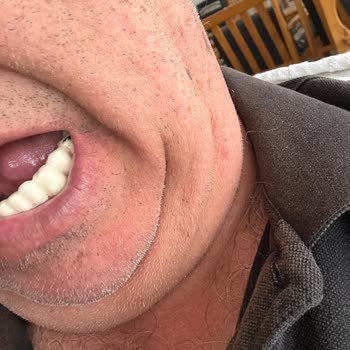 Cadde Dental Dış Lerimiz Yapılmadan Paramız Alindi