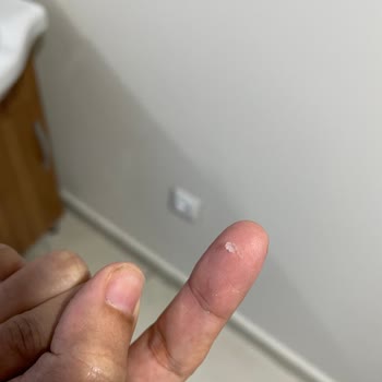 Sleepy Bio Natural Kristalleşme Ve Pişik Sorunu