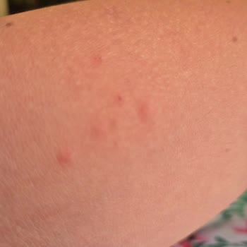 Etstur.com Tatili Rezil Etti