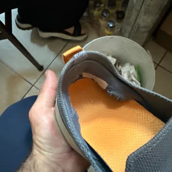 Skechers Bir Yıllık Ayakkabıda Deformasyon Sorunu