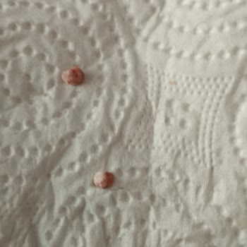 Filiz Makarnadan Çıkan Çakıl Taşları Diş Kırıyordu!