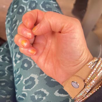 Pastel Kozmetik Pastel Oje Tırnakta Çıkmayan Büyük Büyük Lekeler Bıraktı