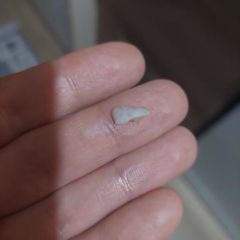 Migros Uzman Kasap Hamburger Köfteden Tırnak Çıktı.