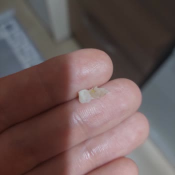 Migros Uzman Kasap Hamburger Köfteden Tırnak Çıktı.