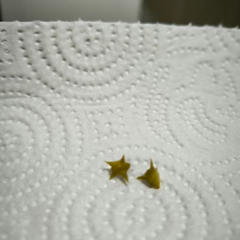 Harras Dondurulmuş Bezelye İçinden Dikenler Çıktı