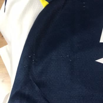 Fenerium Fenerbahçe Formasının Bazı İplikleri Havaya Kalktı