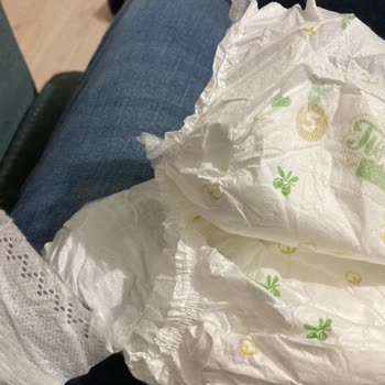 Baby Turco Yapıştırma Yerinin Kopması