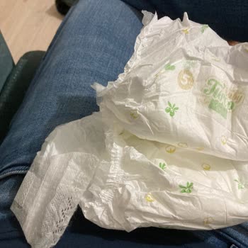 Baby Turco Yapıştırma Yerinin Kopması