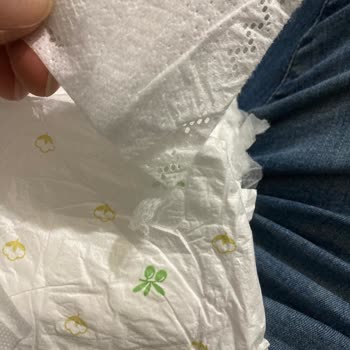 Baby Turco Yapıştırma Yerinin Kopması