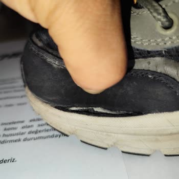 Skechers Ayakkabım Garanti Kapsamına Girmiyormuş...