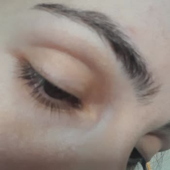 Neutrogena Göz Ve Yüz Yanması Sonrası Acil Destek!