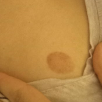 Çallı Meydan Tıp Merkezi Antalya Çallı Meydan Tıp Şikayeti