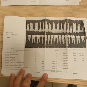 Avrupa Diş Polikliniği Sefaköy Avrupa Diş, Yaklaşım İşleyiş Ve Birbirini Tutmayan İki Fatura