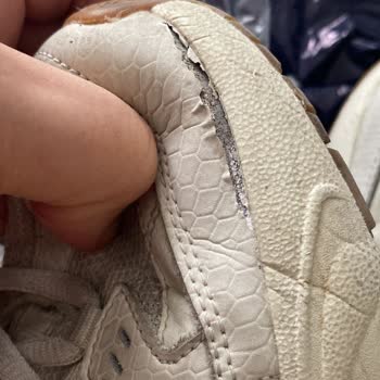 Skechers Dikişi Açılan Ayakkabıya Kullanıcı Hatası Dendi.