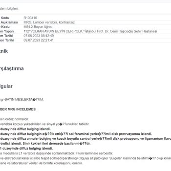 Media Markt Garanti Uzatma Ve Koruma Paketi Yalanları!