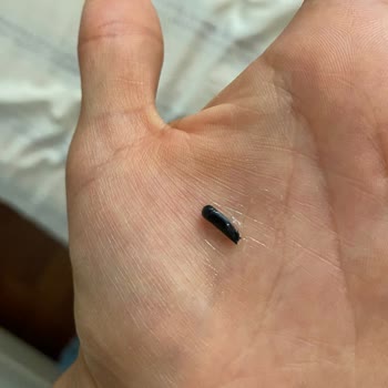 İncia Pişik Kremi İçinden Plastik Parçası Çıktı (! )