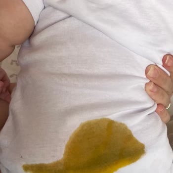 Prima Premium Care Üretim Hatası