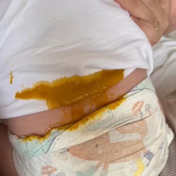 Prima Premium Care Üretim Hatası