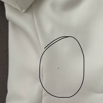 Zara Marka Elbise Lekeli Ve Hatalı