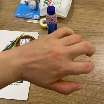 Fairy для мытья посуды испортил мои руки