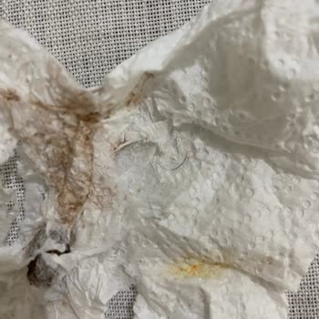 Kellogg's Mısır Gevreği İçinde Kıl Çıktı