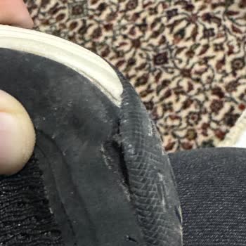 Skechers Beğenerek Aldığım Ayakkabının Ucu Açıldı