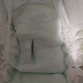 Canbebe Bebek Bezlerinde Hijyene Dikkat Edilmiyor