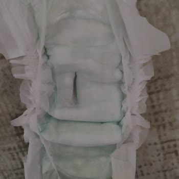 Canbebe Bebek Bezlerinde Hijyene Dikkat Edilmiyor