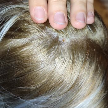 Palette 10.1 Boyaya Asit Katmışlar