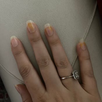 Flormar Kırmızı Oje Mağduru