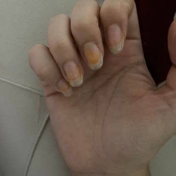 Flormar Kırmızı Oje Mağduru