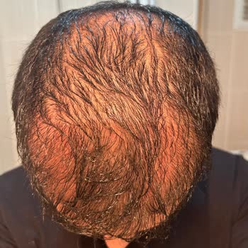 Gold City Hair İstanbul Gold City Hair Pişmanlıktır!