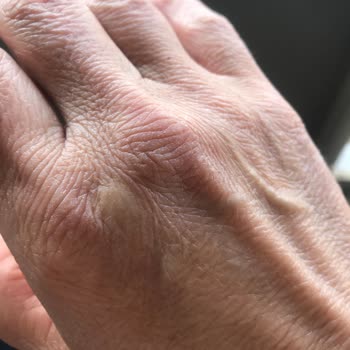 Чистящее средство Cif испортило мои руки