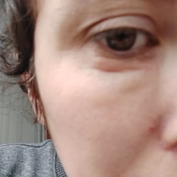 La Roche Posey Hydraphase Göz Altı Kremi